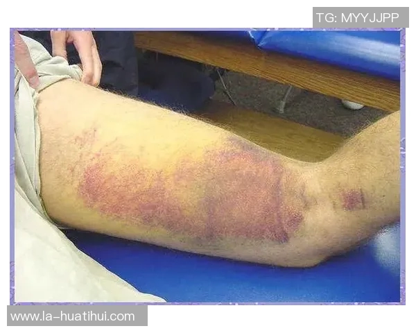 左大腿腘绳肌损伤,世体:拉波尔特可能因伤缺席两个月 左大腿腘绳肌损伤,世体:拉波尔特可能因伤缺席两个月